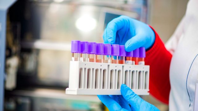 COVID-19 Romania | 144 de cazuri noi 24 Aprilie 2020 4 mai