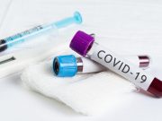 COVID-19 România | 143 de cazuri noi depistate în ultimele 24 de ore 143 de cazuri noi depistate în ultimele 24 de ore