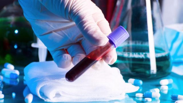 COVID-19 România | 1 029 de cazuri confirmate Raportul cazurilor 30 aprilie