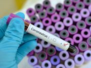 Coronavirus România | Raportul cazurilor pentru 6 Aprilie 2020 | Situația pe județe Raportul cazurilor pentru 6 aprilie 2020