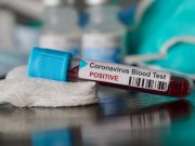 Coronavirus România | Raportul cazurilor pentru 7 Aprilie 2020 | Situația pe județe Raportul cazurilor pentru 7 Aprilie 2020
